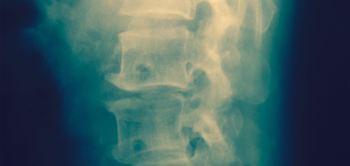 x-ray of spine